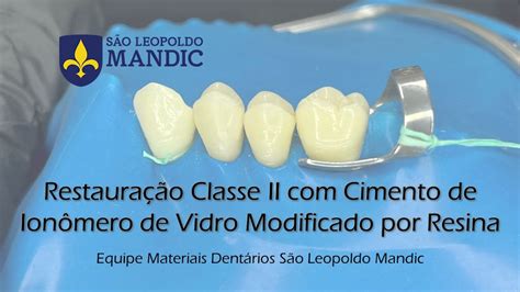  Ionomero de Vidro: Uma Revolução na Restauração Dental e Revestimentos Protetores?